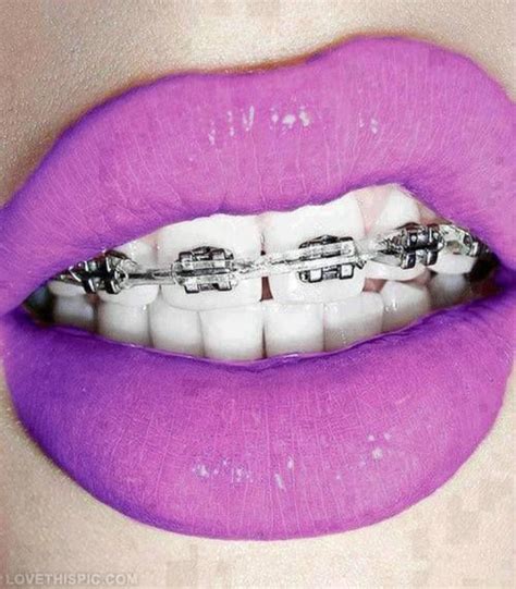 Purple Lips And Braces Lips Purple Lipstick Lip Pictures Lipstick