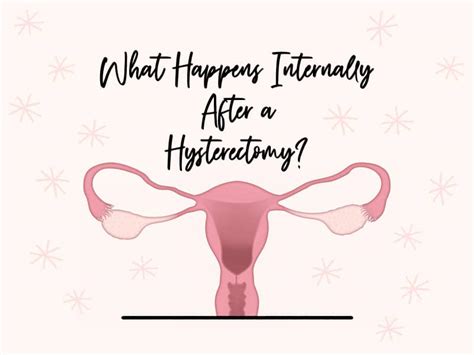 What Happens Internally After A Hysterectomy Nava Health
