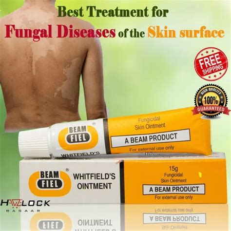 Tinea Versicolor Antifungal Relief Herbal Cream Treat Skin Rash And