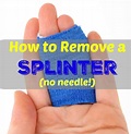 How to Remove a Splinter without a Needle | Healthy Home Economist