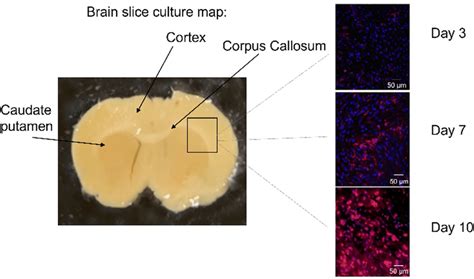 Brain Slice Culture Sketch Map Brain Slices Whole Cerebrum Were Cut