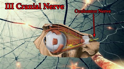 Ultimately contralateral cranial nerve 3 involvement ensues. Oculomotor Nerve Palsy, III Cranial Nerve palsy- Medical ...