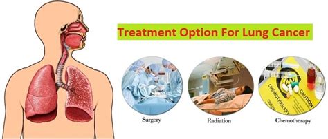 How Is Lung Cancer Treated Quora