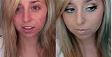 Images of Makeup To Cover Acne