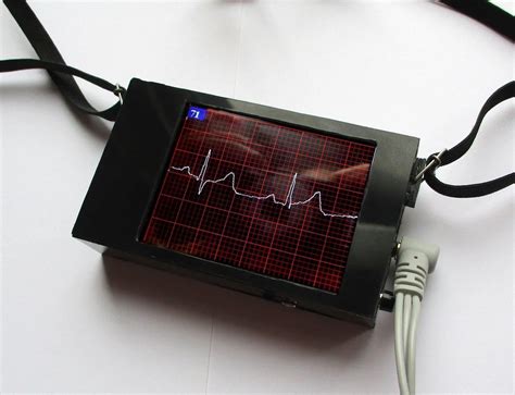 An Arduino Ecg Device With An Integrated Display Laptrinhx