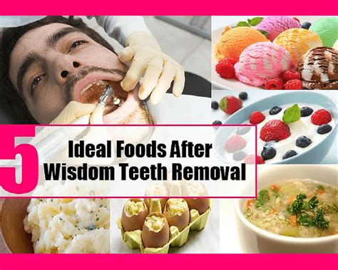 Best Foods To Eat After Wisdom Teeth Removal Reddit Get More Anythinks