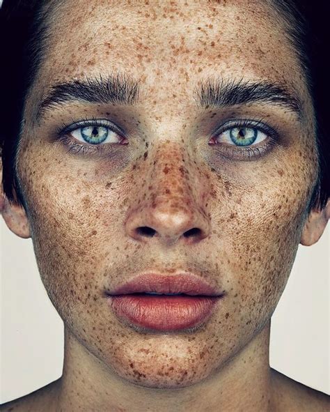 Photographer Takes Portraits Of Freckled People To Celebrate Their Unique Beauty Bored Panda