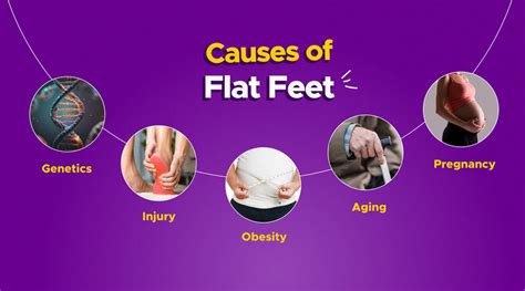 flat feet causes and symptoms myfrido