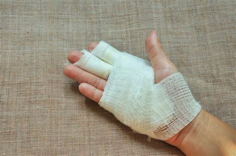 Injury Hand With Bandage Stock Image Image Of Care Medical 32328629