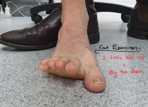 Flat Feet Vs Arched Feet Know The Differences And How To Treat Them