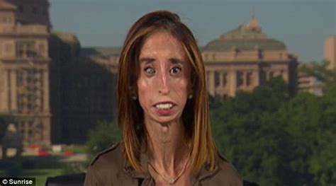 How Worlds Ugliest Woman Lizzie Velasquez Fought Back Against The Bullies Daily Mail Online