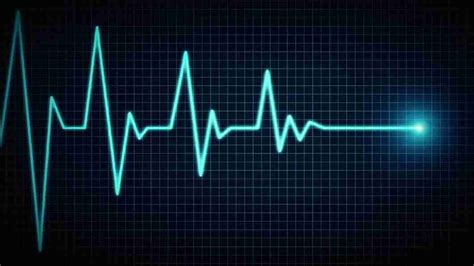 Heart Rate Normal Heart Rate For Men And Women Types Treatment