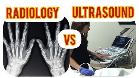Radiology Vs Ultrasound The Major Differences Between The Two Xray