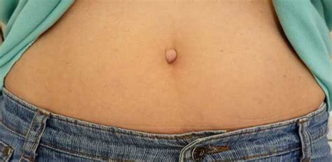 10 Things You Should Know About Your Belly Button