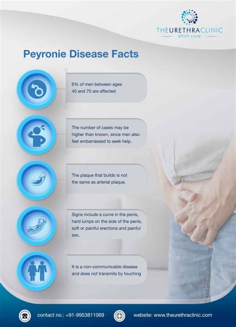 Everything You Need To Know About Peyronies Disease The Urethra Clinic
