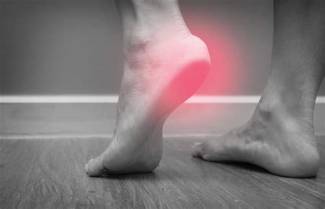 Burning And Tingling In Feet Could Indicate Small Fiber Neuropathy