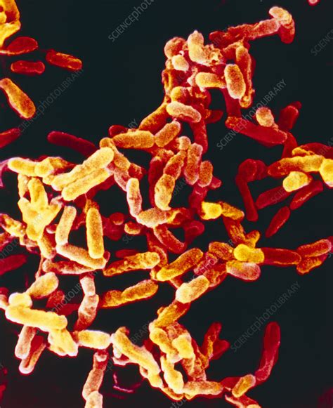 Pseudomonas Aeruginosa Bacteria Stock Image B2200525 Science