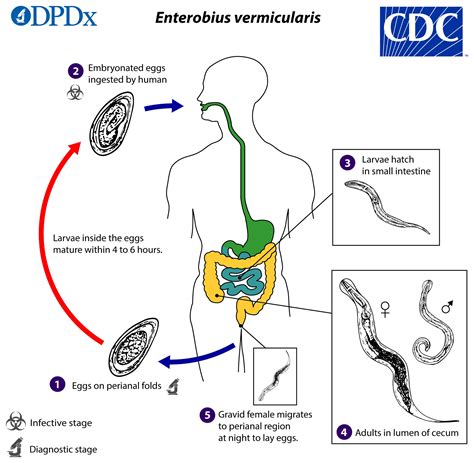 Enterobius Vermicularis Morphology Life Cycle Transmission