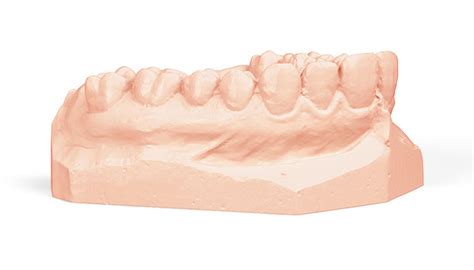 Nextdent Resin Cental Dental