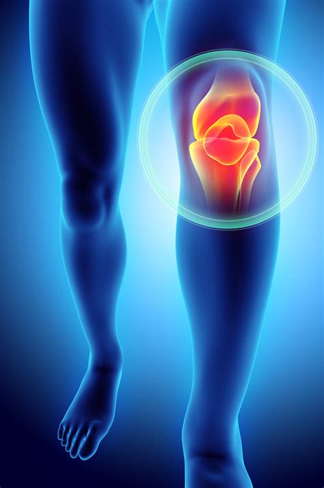 Can You Virtually Improve Your Knee Pain Harvard Health