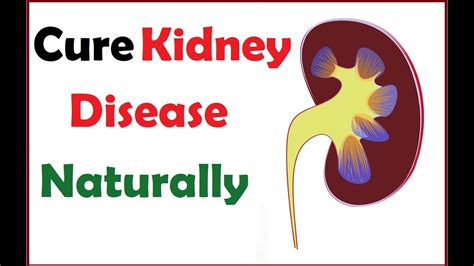 9 Steps To Cure Kidney Disease Naturally How To Repair Kidney Damage