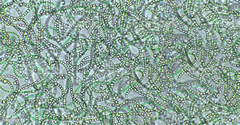Nostoc Sp Bluegreen Algae Under Microscopic View Cyanobacteria Stock