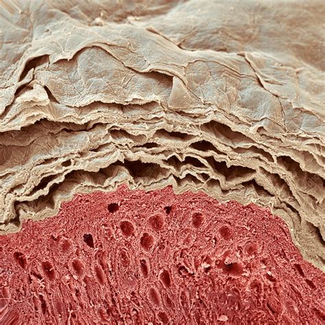 Structure and function of the skin. Skin layers, SEM - Stock Image - P710/0441 - Science Photo ...
