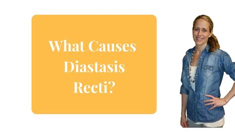 What Causes Diastasis Recti Youtube