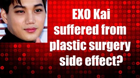 Exo Kai Suffered From Plastic Surgery Side Effect Youtube