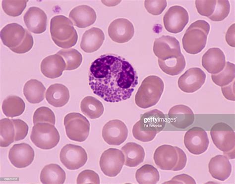 Eosinophil White Blood Cell Occur In Allergies 13 Of The Total Of White