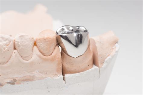 The Different Types Of Dental Crowns Explained Newbury Dental Group