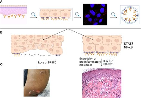 Frontiers Insights Into The Pathogenesis Of Bullous Pemphigoid The