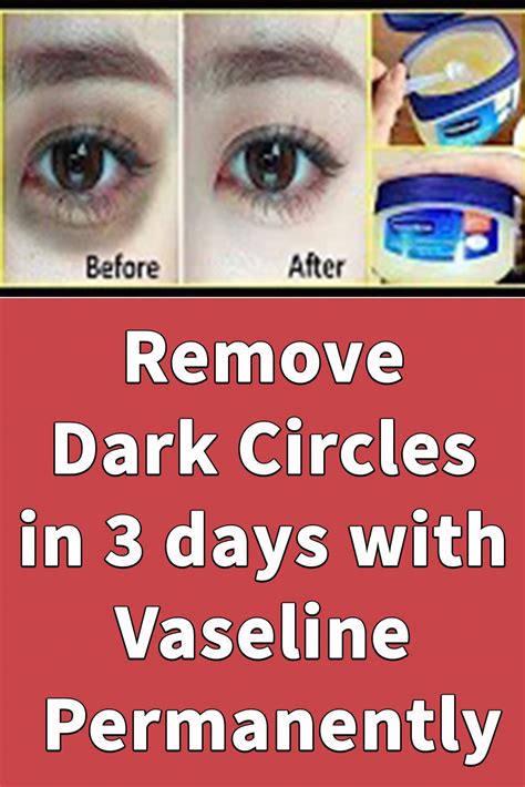 How To Get Rid Of Eye Bags With Vaseline HOWOTRE