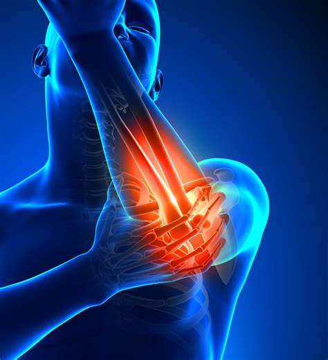What Is Tennis Elbow Causes Symptoms And Treatment Panther Sports