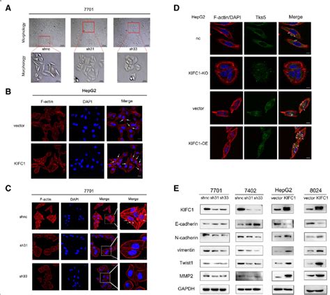 Kifc1 Induces Emt In Hcc Cells A Cell Morphology Changed From A