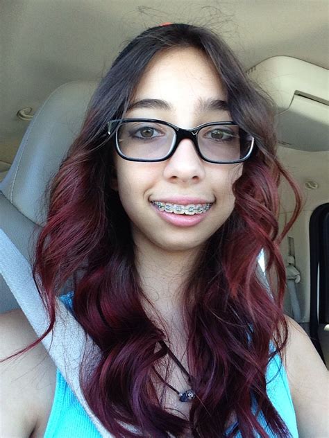 Pin By Kelly Spragg On Braces Cute Girls With Braces Braces And Glasses Cute Braces