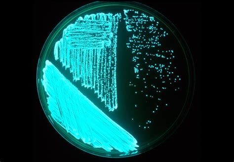 Vibrio Fischeri Scheda Batteriologica E Approfondimenti