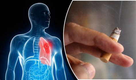 lung cancer decline smoking ban has helped almost two million give up in a decade health