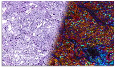 Large Scale Ai In Digital Pathology Without The Heavy Lifting Aws