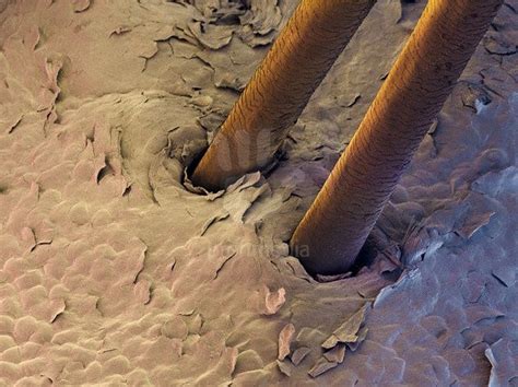 Human Skin And Hair Microscopic View Macromicro Photos Pinterest