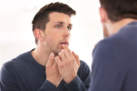 Dark Spot On Lip Can Be Melanoma Scary Symptoms