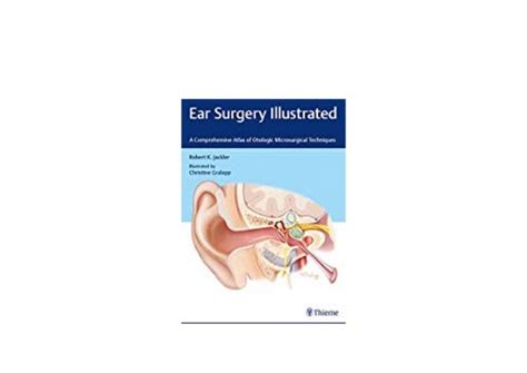 Ebookpaperback Library Ear Surgery Illustrated A Comprehensive Atlas