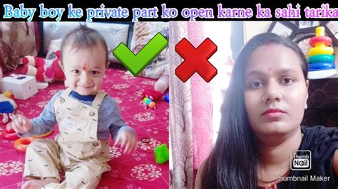 How To Open Baby Boy Private Parttips Problems What To Do And What