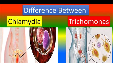 Difference Between Chlamydia And Trichomonas Youtube
