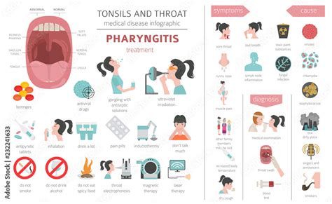 Tonsils And Throat Diseases Pharyngitis Symptoms Treatment Icon Set Medical Infographic
