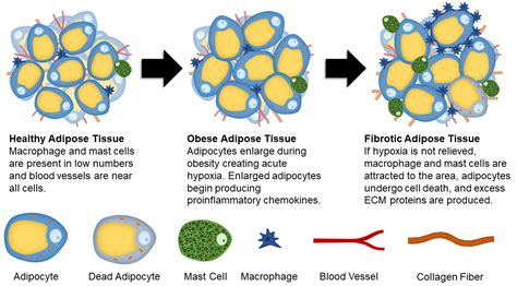 IJMS Free Full Text Adipose Tissue Fibrosis Mechanisms Models And Importance