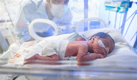 Cuidados Esenciales Cómo Cuidar A Un Bebé Prematuro Todos Somos Uno