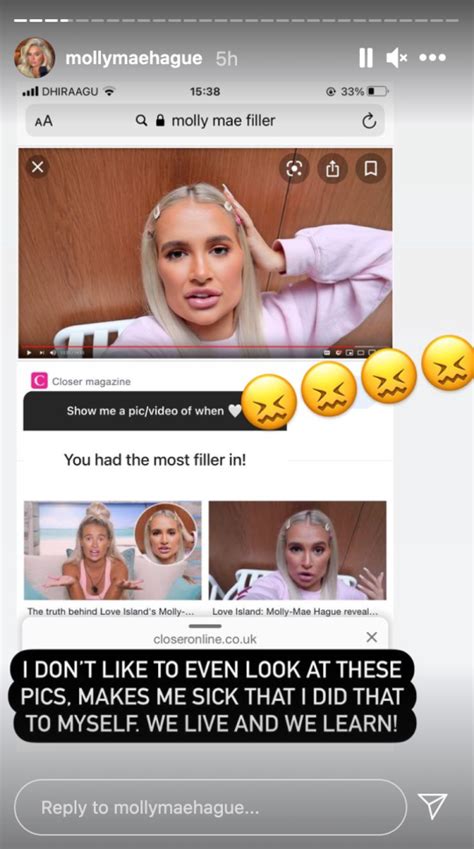 Molly Mae Hague Feels Sick Seeing Old Photos Of Her Lip Fillers Metro News