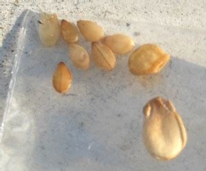 They are little sacs filled with eggs. More Sesame Seeds found in Bed: Tape Worm Eggs - What's That Bug?