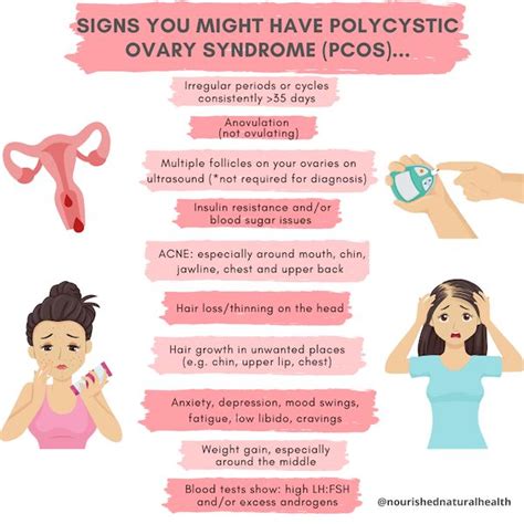 Pcos Not A Huge Log Book Pictures Gallery